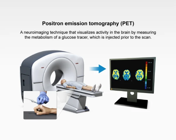 Image showing an individual being injected with a radioactive glucose substance and then undergoing a computed tomography scan.